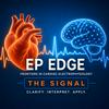 undefined EP Edge™  The Signal