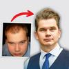 undefined Hair Loss Solutions That Work – 2025 Breakthroughs