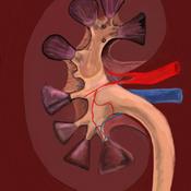 Podcast Paciente de hemodiálisis