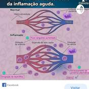 Podcast PROFERIC Aula Inflamação